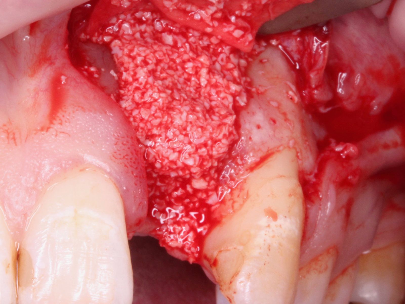 Soft and hard tissue augmentation workshop