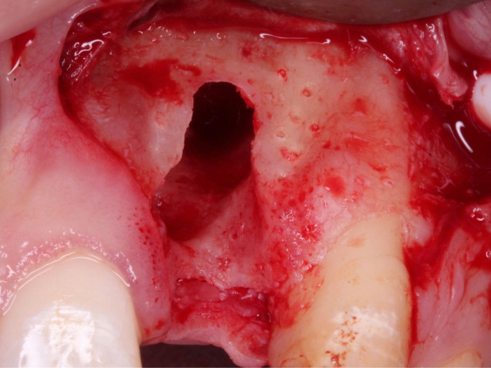 Grafting Masterclass Melbourne